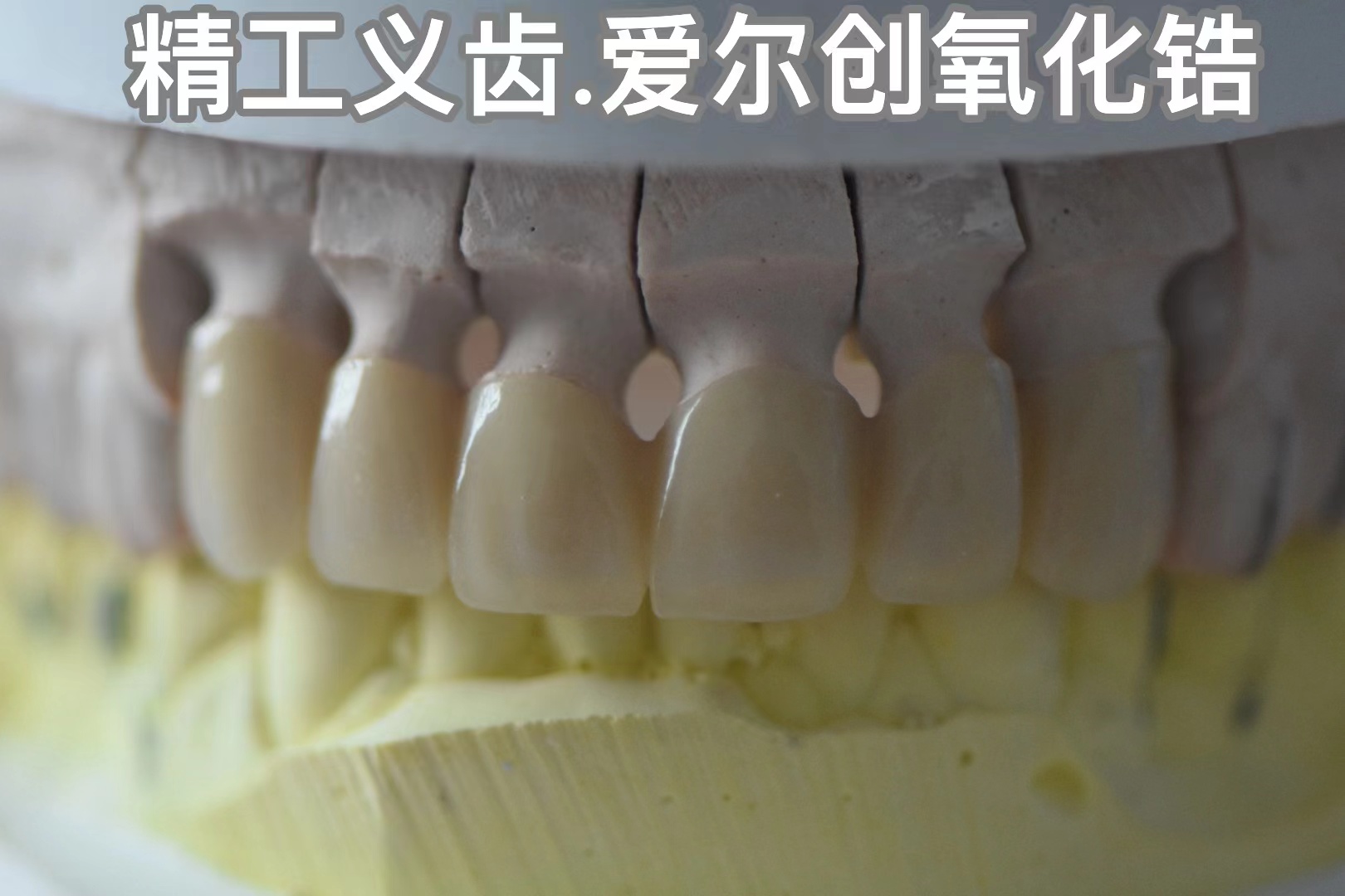 精工義齒.愛(ài)爾創(chuàng)氧化鋯
